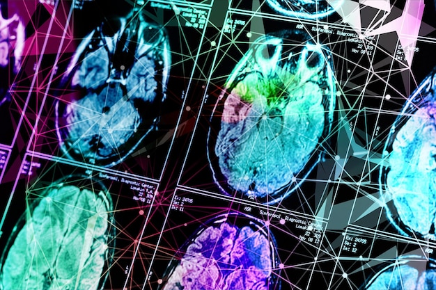A brain scan highlighting areas associated with improved cognitive function. The scan is presented in a futuristic, high-tech style, with annotations emphasizing the areas of enhanced activity.